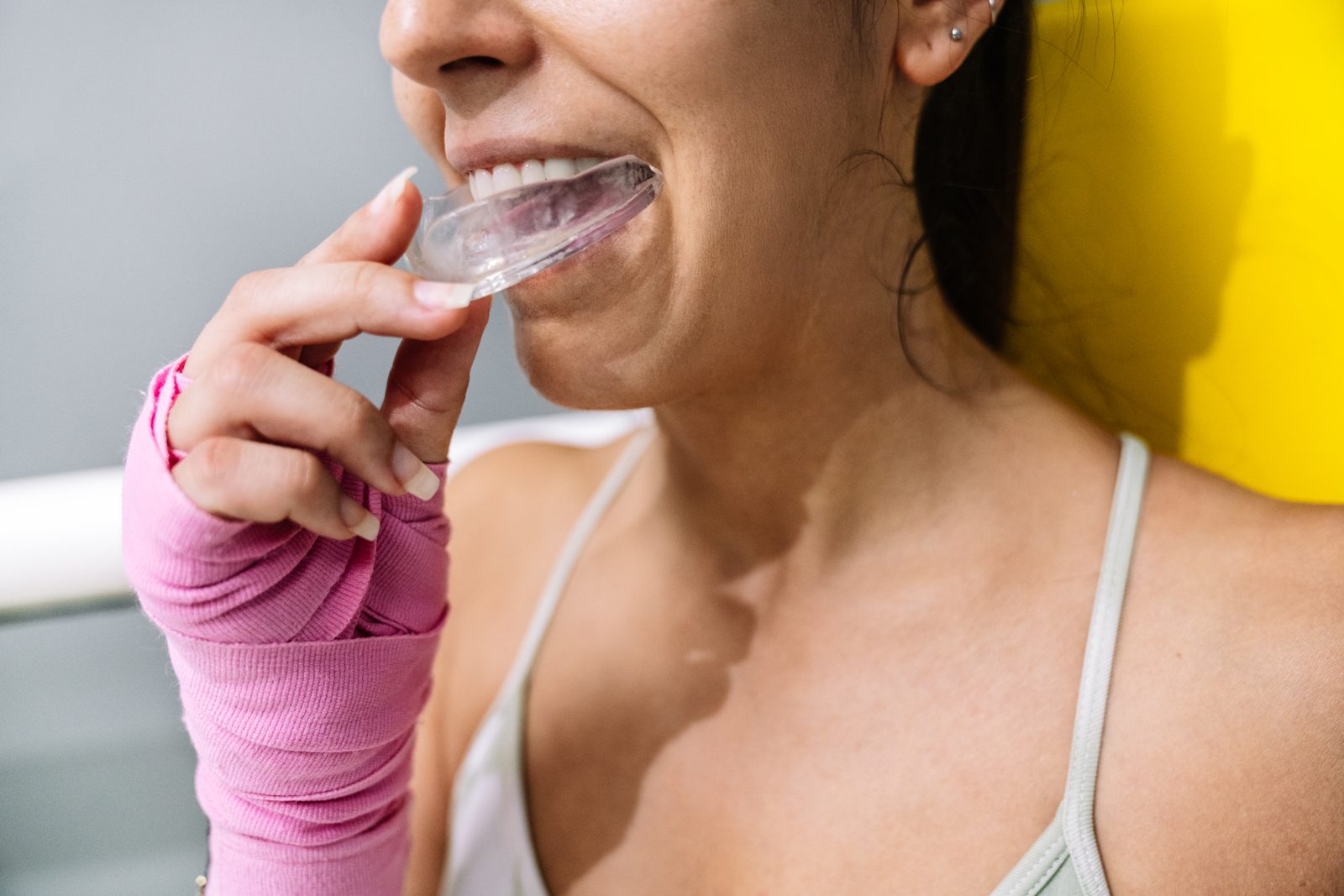 Custom Mouth Guards at Mercy Denture Clinic in Edmonton
